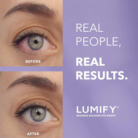 LUMIFY™