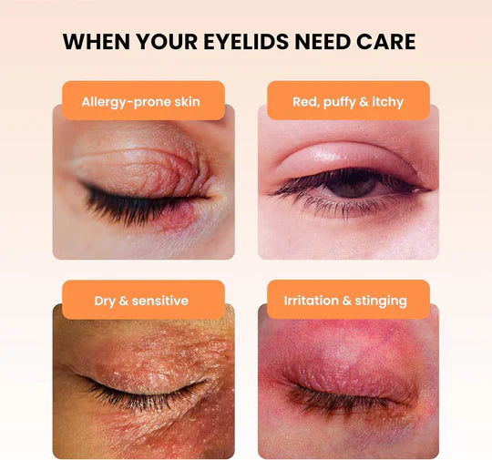 BlephaDerm